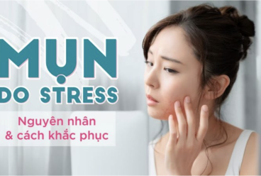 Thay đổi hormone khi căng thẳng (Stress) có thể làm nổi mụn
